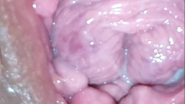 Opening Wide My Hairy Vagina: Hilarious Cheeky Fun Spread!